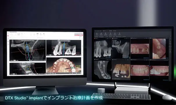 フラップレスインプラント | 三国丘歯科クリニック｜堺市堺区三国ヶ丘