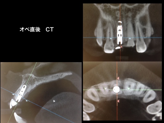 CT画像