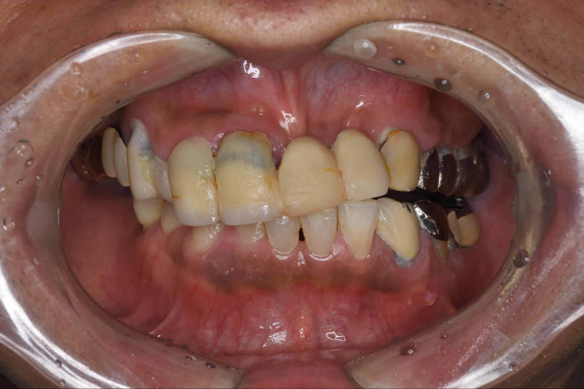 初診時症例画像